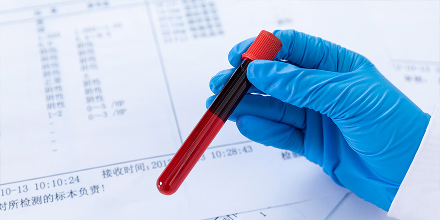 产前亲子鉴定(图3)